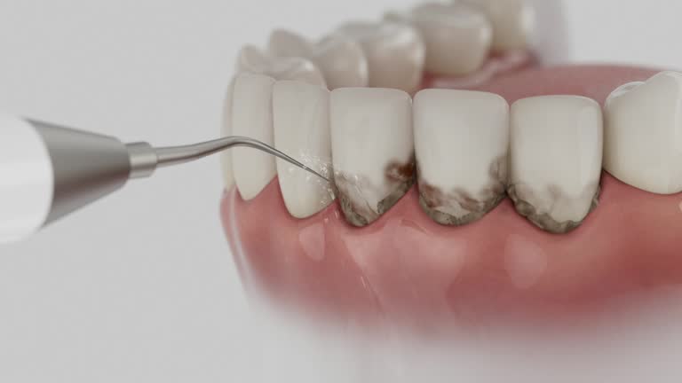 Reliable Teeth Whitening contractor in Hernando, MS by Smile Center Dentistry